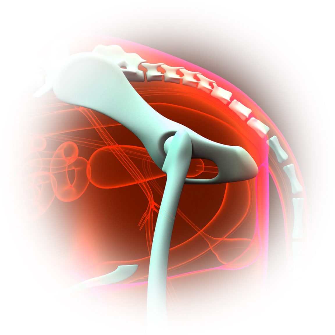 Hip Luxation IGOS Veterinary